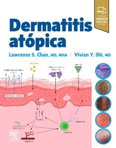 Dermatitis atópica