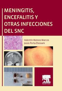 Meningitis, encefalitis y otras infecciones del SNC