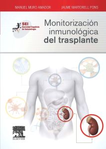 Monitorización inmunológica del trasplante