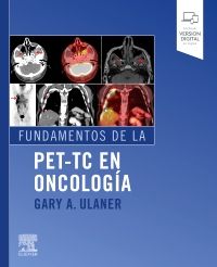 Fundamentos de la PET-TC en oncología