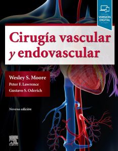 Cirugía vascular y endovascular