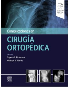 Complicaciones en cirugía ortopédica