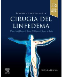 Principios y práctica de la cirugía del linfedema