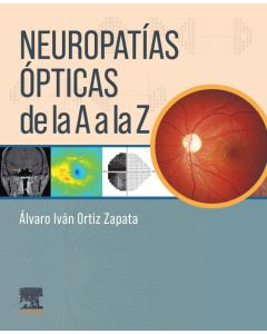 Neuropatías ópticas de la A a la Z