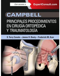 Campbell. Principales procedimientos en cirugía ortopédica y traumatología
