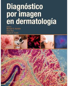 Diagnóstico por imagen en dermatología
