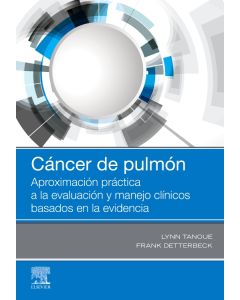 Cáncer de pulmón