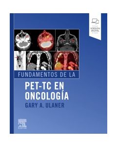 Fundamentos de la PET-TC en oncología